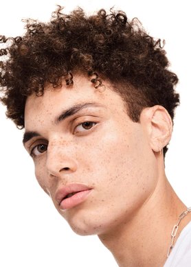 acne-y-estres-consejos-para-mantener-la-calma-y-tomar-el-control