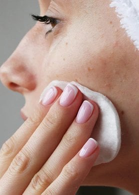 Acne senil