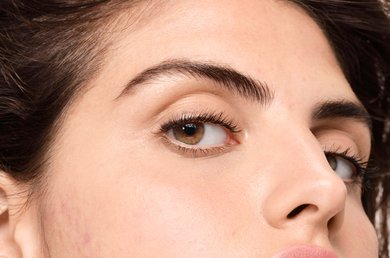 que-es-el-acne-hormonal-y-como-una-rutina-de-cuidado-de-la-piel-puede-ayudar