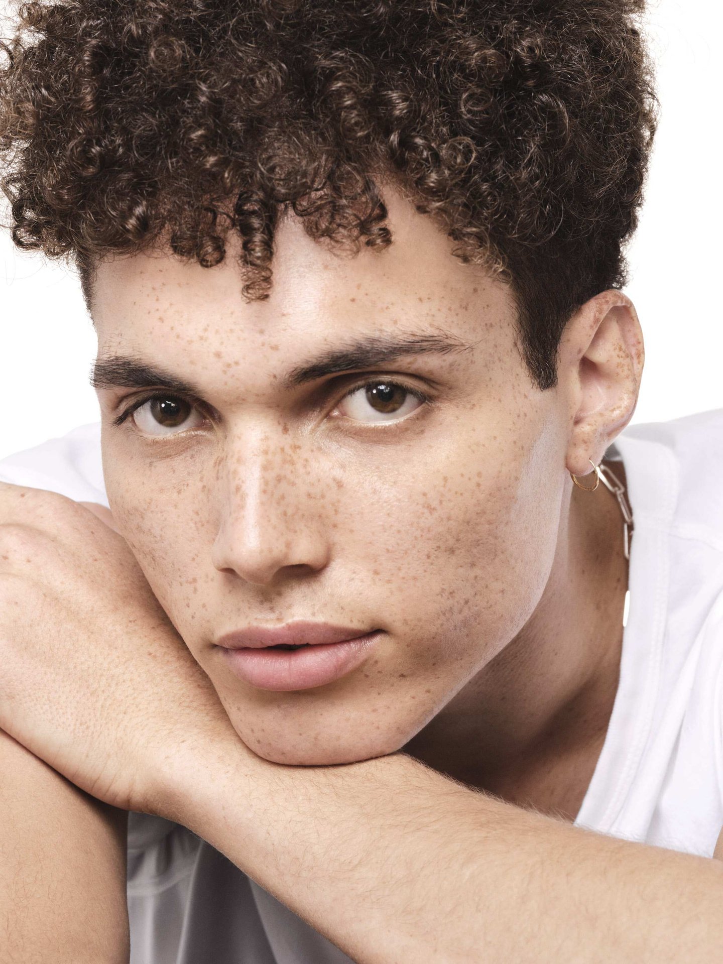 acne-invernal-como-tratar-la-piel-seca-propensa-a-las-imperfecciones