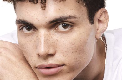 acne-invernal-como-tratar-la-piel-seca-propensa-a-las-imperfecciones