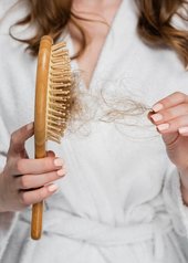 alopecia androgénica mujer