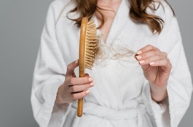 alopecia androgénica mujer