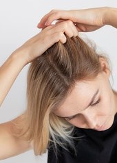 CÓMO TRATAR LA CASPA Y LA DERMATITIS SEBORREICA DEL CUERO CABELLUDO