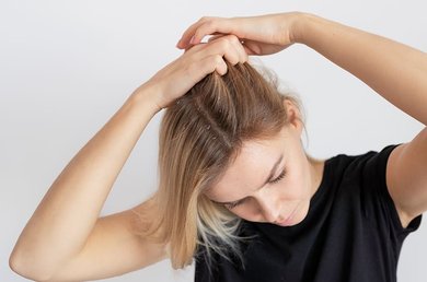 CÓMO TRATAR LA CASPA Y LA DERMATITIS SEBORREICA DEL CUERO CABELLUDO
