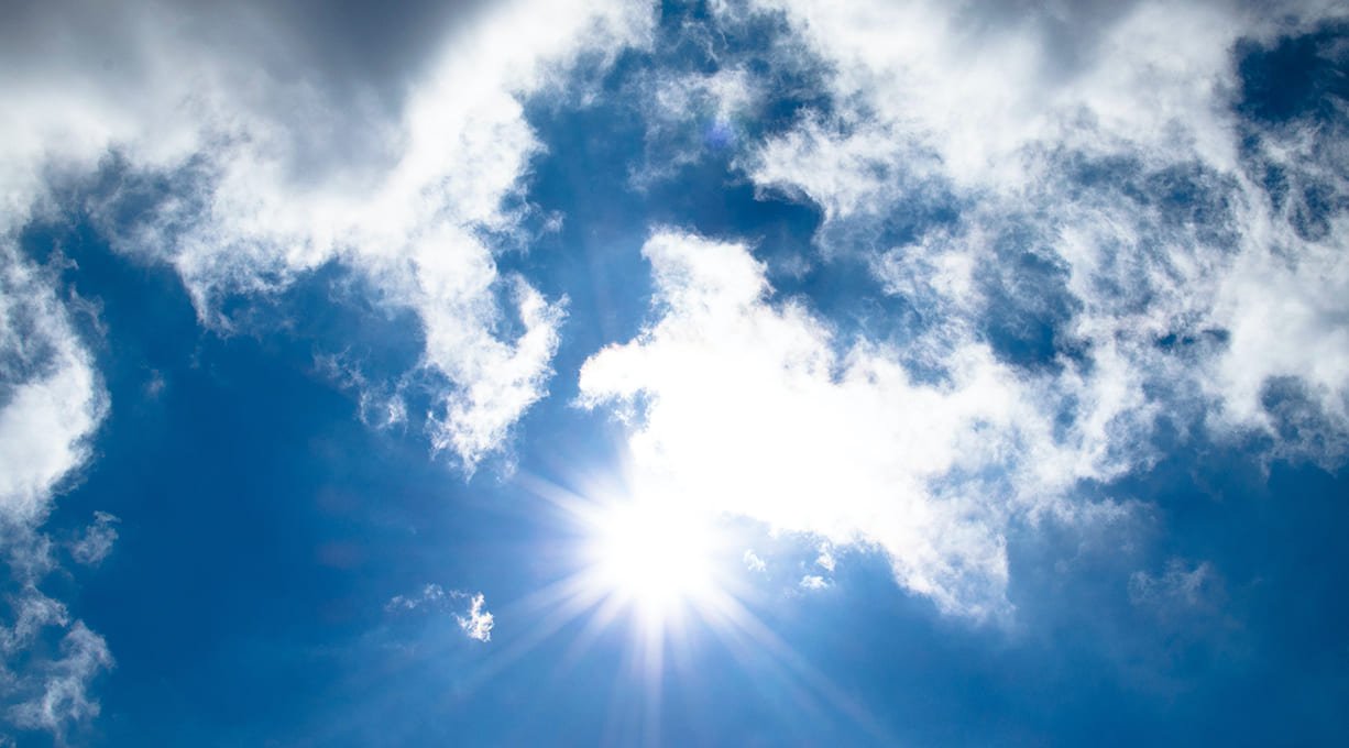 ¿EL CUERO CABELLUDO SE QUEMA CON EL SOL?