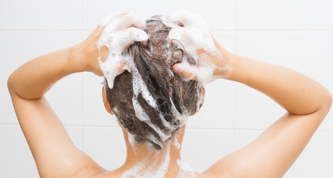 descamación capilar