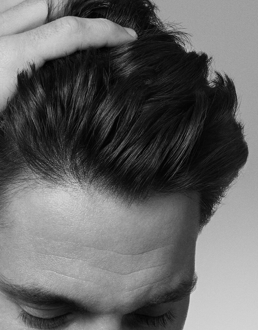 todo-lo-que-necesitas-saber-sobre-la-caspa-adherente