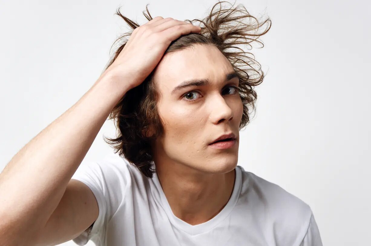 caída de pelo por estrés