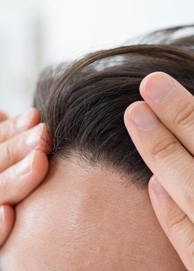 Prevenir la caída del cabello