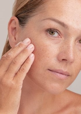 Cómo prevenir las manchas