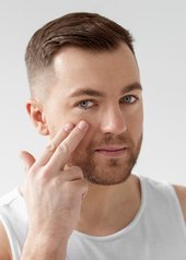 manchas en la cara en hombres