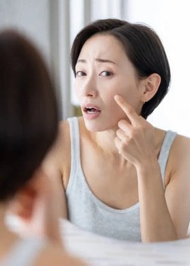 colágeno y menopausia