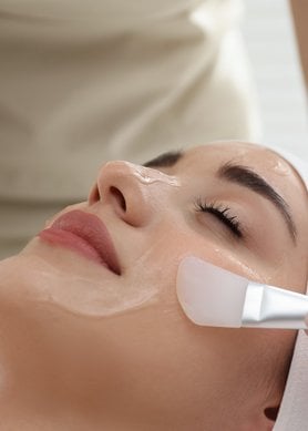 Peeling químico facial: ¿cuáles son sus beneficios?