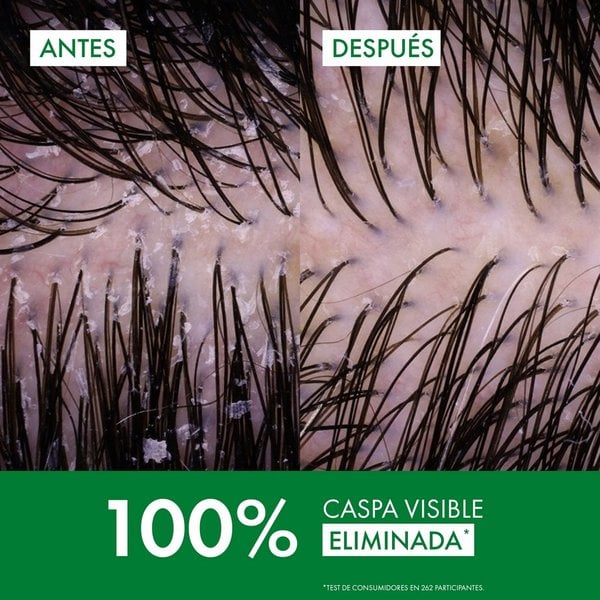 DERCOS Anticaspa DS Cabello Normal a Graso